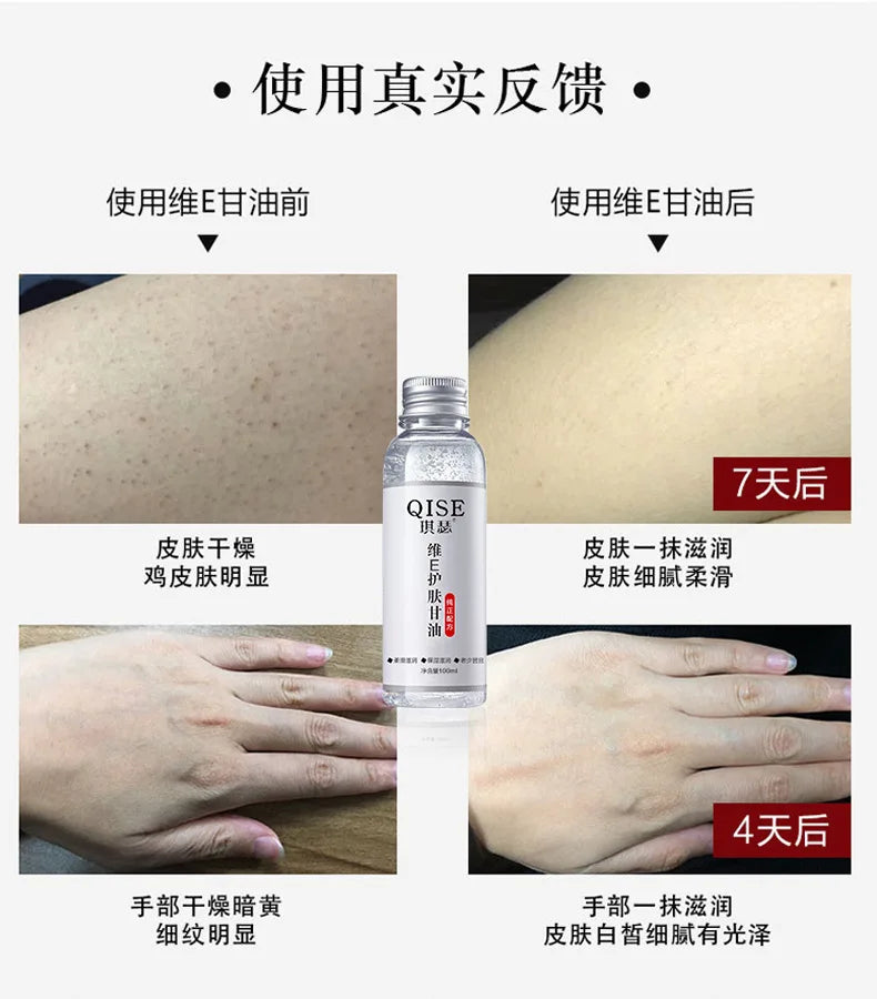 Skin Care, Glycerin, Moisturizing, Moisturizing and Brightening Skin Tone, Improving Dry Skin, Anti-chapped Milk, Whole Body